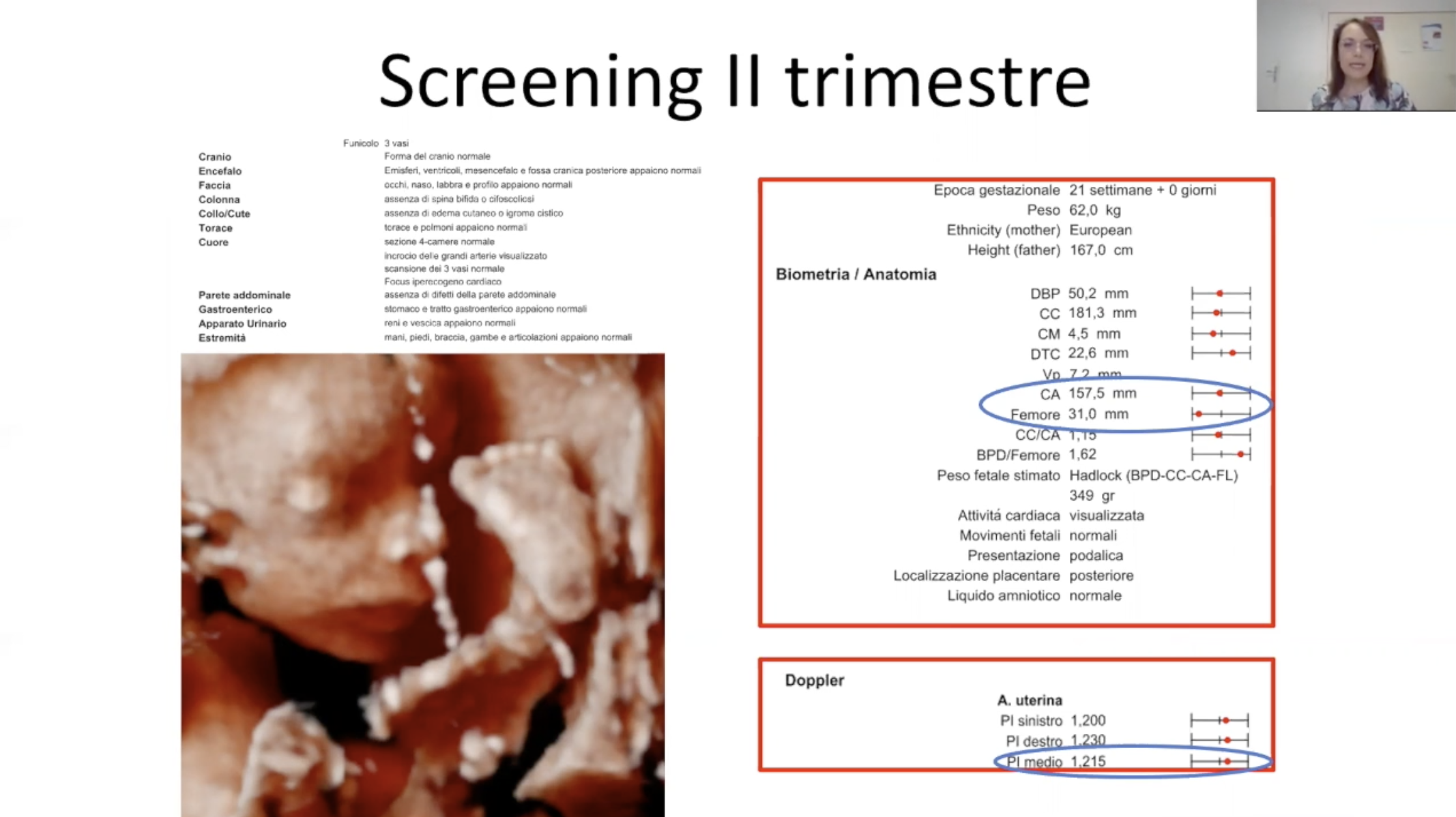 Un caso atipico di feto con ritardo di crescita tardivo (late FGR)