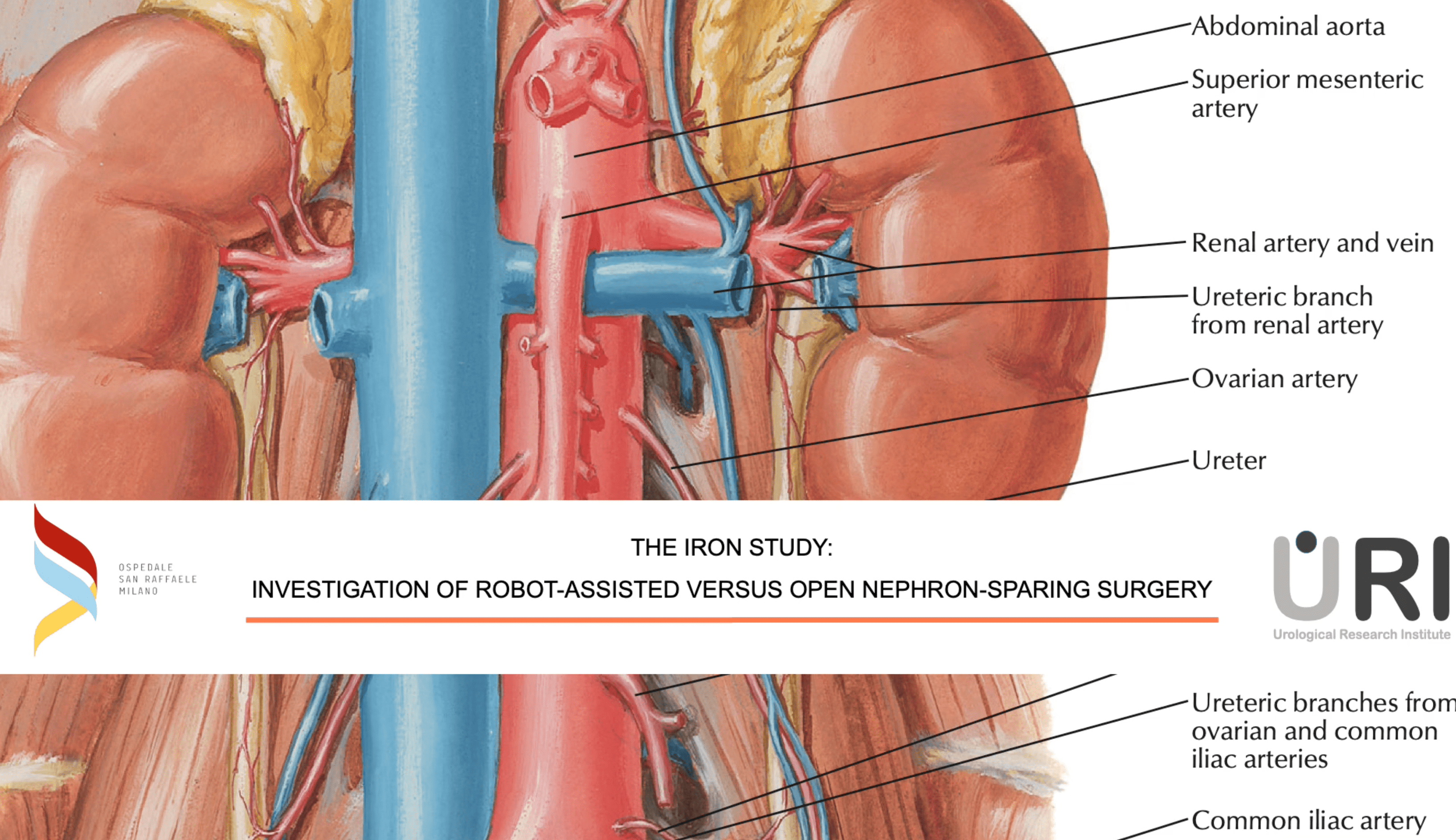 EAU - The IRON study - Investigation of Robot-assisted versus Open Nephron-sparing surgery